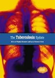 The Tuberculosis Update (Disease Update)