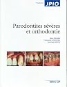 Parodontites s&eacute;v&egrave;res et orthodontie