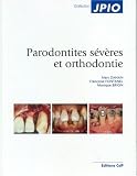 Parodontites sévères et orthodontie