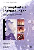 Produkt-Bild: Periimplant&auml;re Entz&uuml;ndungen: &Auml;tiologie, Pathogenese, Diagnostik und aktuelle Therapiekonzepte