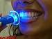 Laser Tooth Whitening System