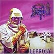Leprosy