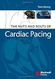 Nuts and Bolts of Cardiac Pacing Image of Nuts and Bolts of Cardiac Pacing