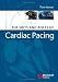 Book Nuts and Bolts of Cardiac Pacing