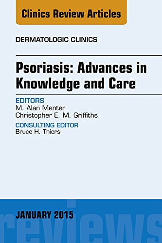 Psoriasis: Advances in Knowledge and Care, An Issue of Dermatologic Clinics, (The Clinics: Dermatology)