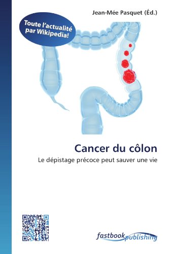 Cancer du côlon: Le dépistage précoce peut sauver une vie (French Edition)
