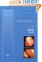 Endometrial Carcinoma and Precursors