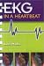 EKG in a Heartbeat