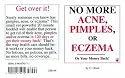 No More Acne, Pimples, or Eczema