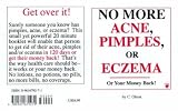 No More Acne, Pimples, or Eczema