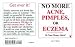   - No More Acne, Pimples, or Eczema