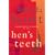 Hen's Teeth