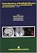 Search : Neurochemistry of Metabolic Diseases - Lysosomal Storage Diseases, Phenylketonuria and Canavan Disease