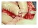 In Vitro Fertilization, Removing Egg from Sheep Ovary Photographic Poster Print by David M. Dennis, 16x12