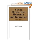 Silent Myocardial Ischemia and Infarction (Fundamental and Clinical Cardiology) by Cohn