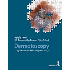 Dermatoscopy. An algorithmic method based on pattern analysis