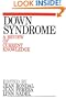 Down Syndrome: A Review of Current Knowledge