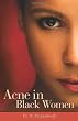 Acne in Black Women