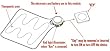 Actipatch / Foot Recovery Kit heel acti-patch for heel pain