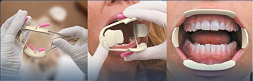 Optiview Lip &amp; Cheek Retractor in Two Sizes: Standard + Small