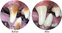 Fresh Breath Teeth Gel Orl Kit