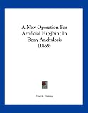 A New Operation For Artificial Hip-Joint In Bony Anchylosis (1869)