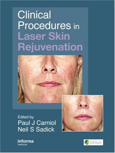 Clinical Procedures in Cosmetic Laser Surgery (Series in Cosmetic and Laser Therapy)