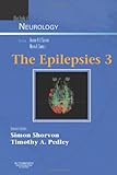 The epilepsies 3