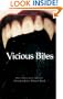 Vicious Bites