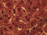 Liver(Hepatic) Cells Kupffer Cells, X400 Photographic Poster Print, 24x18