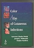 Color atlas of cutaneous infections