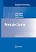 Book Prostate Cancer