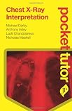 Pocket Tutor Chest X-Ray Interpretation