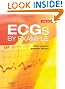 ECGs by Example, 3e