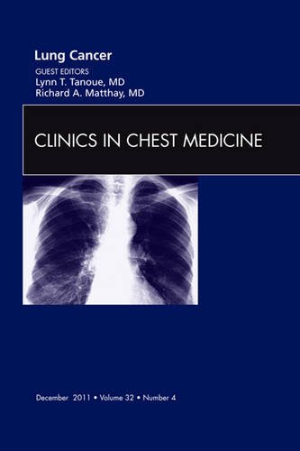 Lung Cancer, An Issue of Clinics in Chest Medicine, 1e (The Clinics: Internal Medicine)