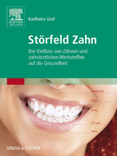 Störfeld Zahn: Der Einfluss von Zähnen und zahnärztlichen Werkstoffen auf die Gesundheit (German Edition)