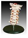 Scientific Anatomical Model : Cervical vertebral column with neck artery, occipital, herniated