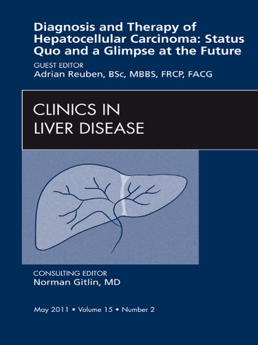 Hepatocellular Carcinoma, An Issue of Clinics in Liver Disease (The Clinics: Internal Medicine)
