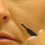 Learn The Truth About Acne-What You Don't Know Will Hurt You