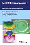 Produkt-Bild: Kontaktlinsenanpassung: In komplizierten Hornhautsituationen