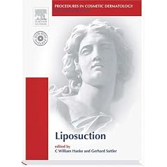 Procedures in Cosmetic Dermatology Series: Liposuction: Text with DVD (Procedures in Cosmetic Dermatology)