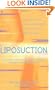 Liposuction