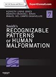 Smith's Recognizable Patterns of Human Malformation: Expert Consult - Online and Print, 7e