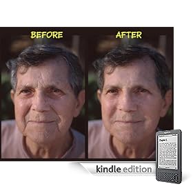 Wrinkle Reduction and Skin Rejuvenation