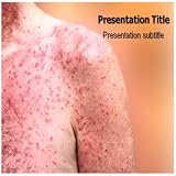 Sun Allergy Powerpoint PPT Templates - Sun Allergy (PPT) Powerpoint Presentation On Template