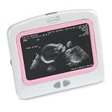 Summer Infant Digital Heart-to-Heart Prenatal Listening System