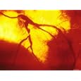 Coronary Angiogram Left Anterior Decending Artery Photographic Poster Print, 16x12