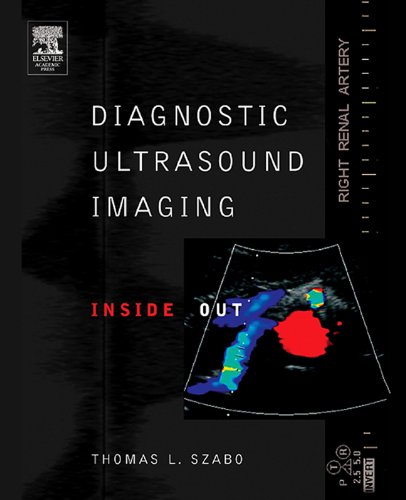 Diagnostic Ultrasound Imaging: Inside Out (Biomedical Engineering)