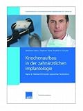 Knochenaufbau in der zahnärztlichen Implantologie. Band 2: Weiterführende operative Techniken: Bd 2