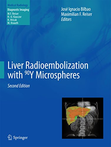 Liver Radioembolization with 90Y Microspheres (Medical Radiology)